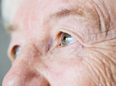 Glaucoma
